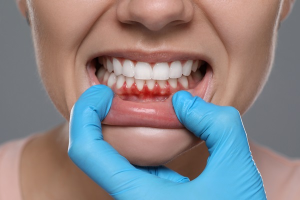 Gum Disease Treatment Options From A General Dentist